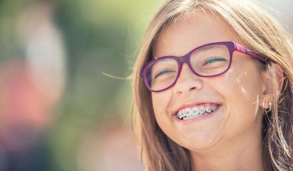 braces for kids in Buffalo MN