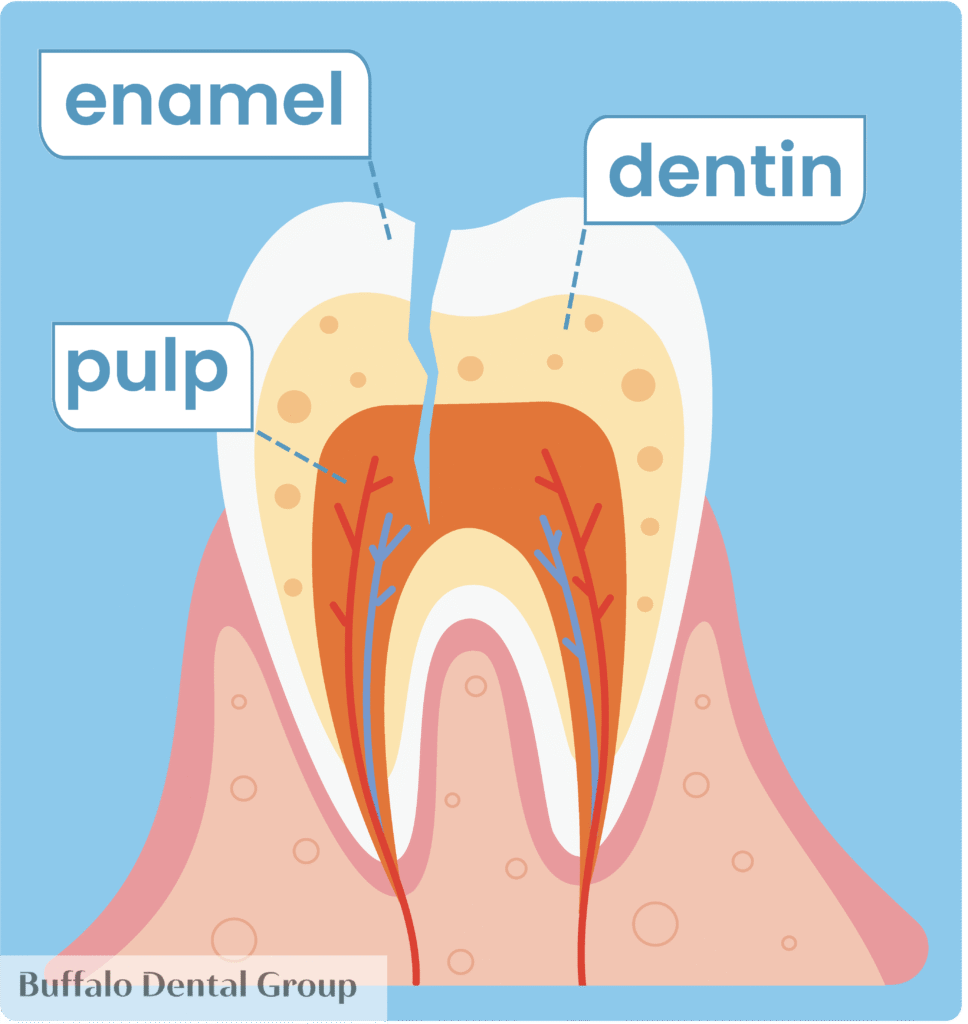 illustration enamel dentin pulp layers of the tooth buffalo dental group